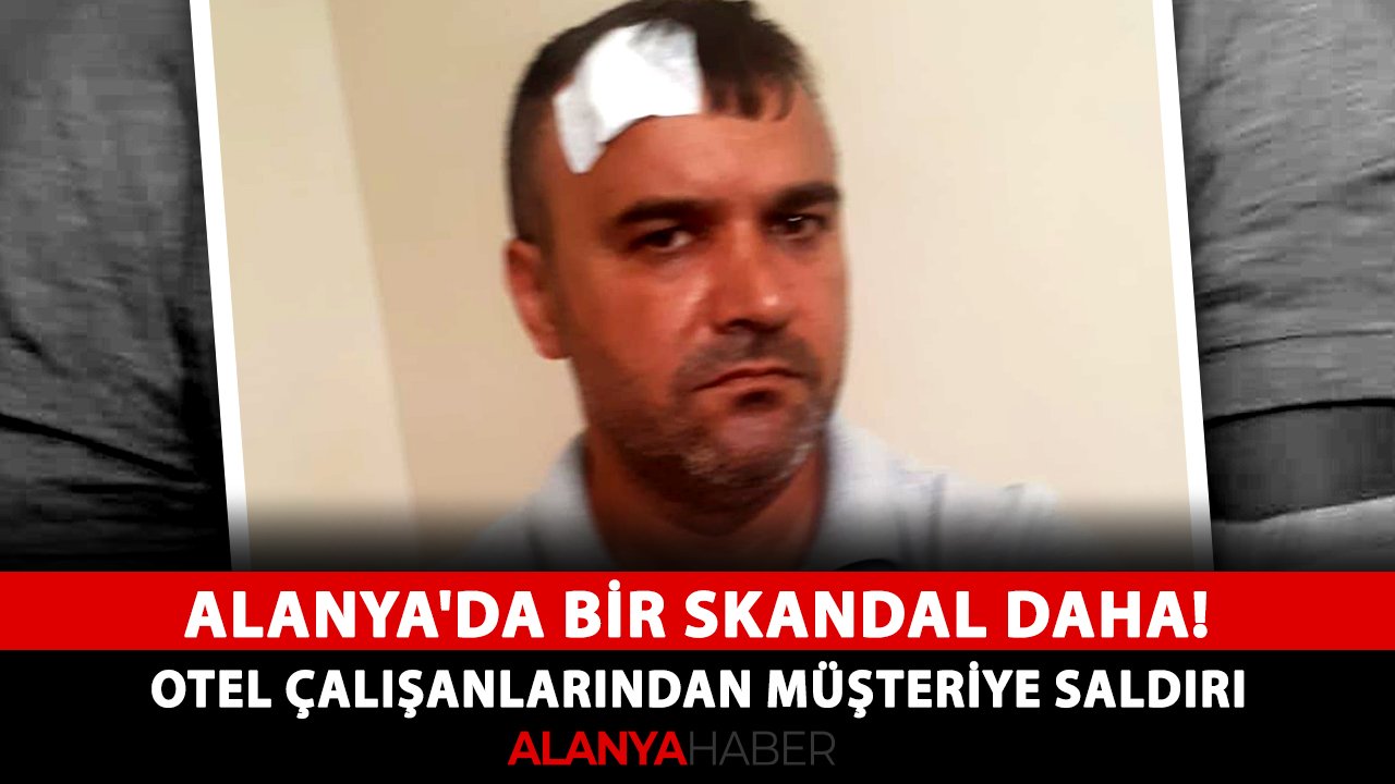 Alanya'da bir skandal daha! Otel çalışanlarından müşteriye saldırı