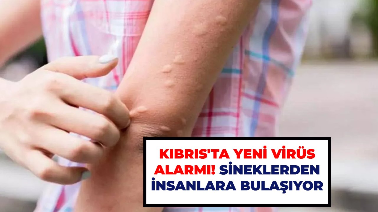Kıbrıs'ta yeni virüs alarmı! Sineklerden insanlara bulaşıyor