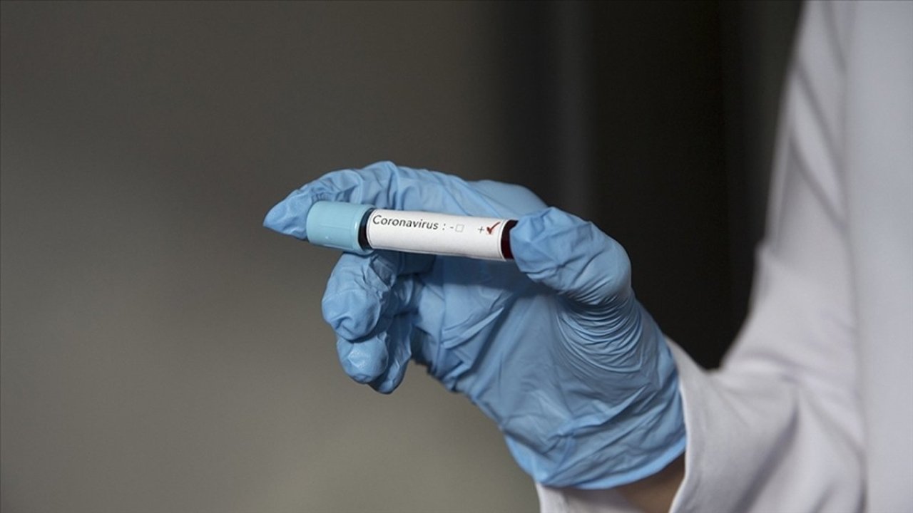 ABD'de Kovid ilacı diye çamaşır suyu sattılar!