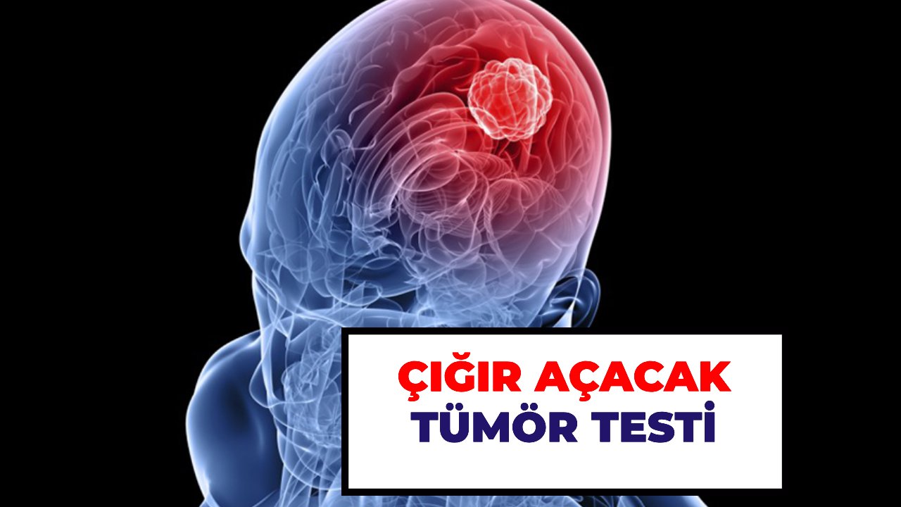 Parmak testi ile tümör tespiti!