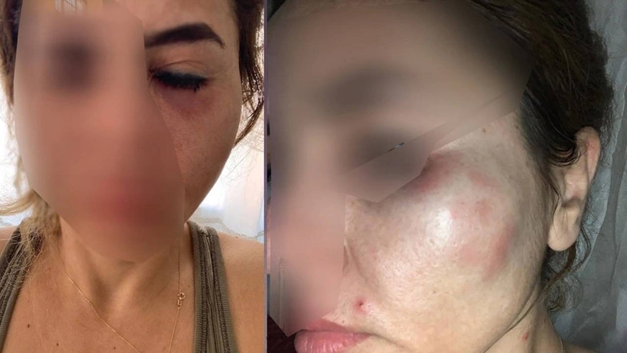 Hamile Kediye Yardım Eden Öğretmene Saldırı: Devletten Gereken Koruma Sağlanamadı